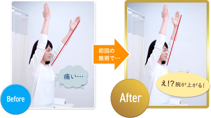 肩こり整体の効果