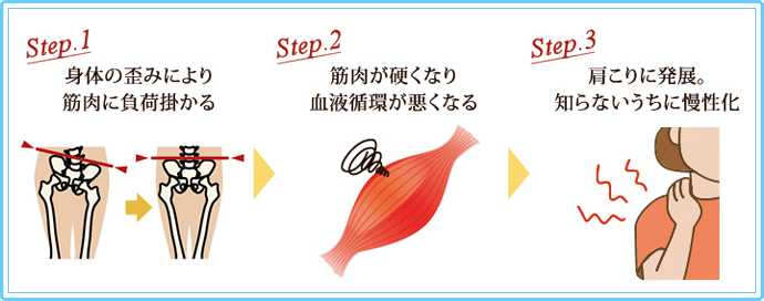 肩こりが生じるまでの流れ